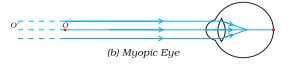 ncert solutions class 10 science chapter 11 human eye and colorful world fig 4