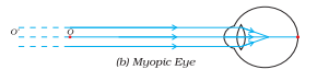 ncert solutions class 10 science chapter 11 human eye and colorful world fig 2
